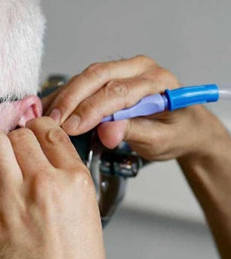 Microsuction ear wax removal procedure